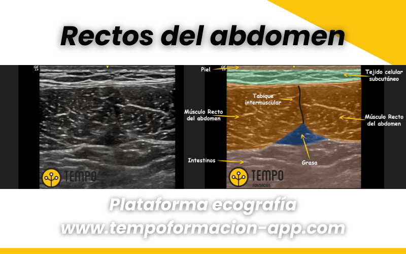 3. Anatomia y ecografia cadera tempo formacion.png